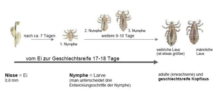 Die Entwicklung der Kopflaus